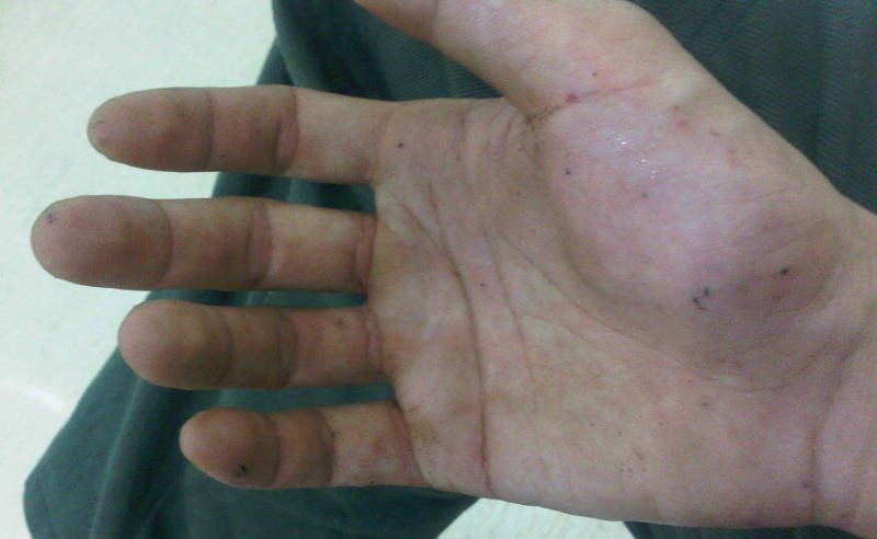 what your palm tells about your health