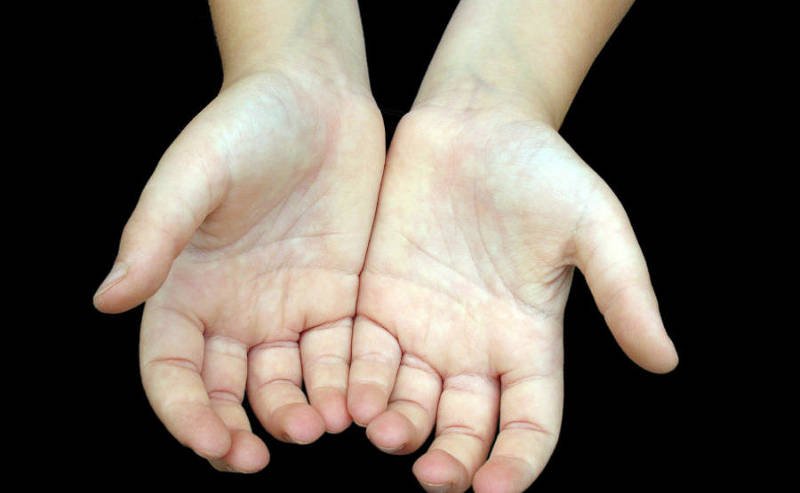what your palm tells about your health