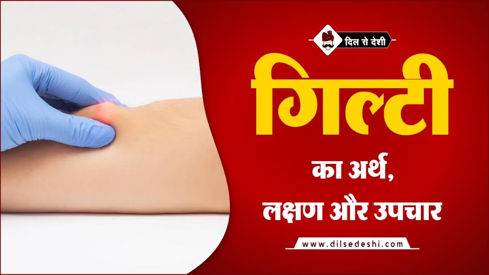 à¤— à¤² à¤Ÿ à¤• à¤®à¤¤à¤²à¤¬ à¤à¤µ à¤‰à¤ªà¤š à¤° Lipoma Meaning Symptoms Treatment In Hindi