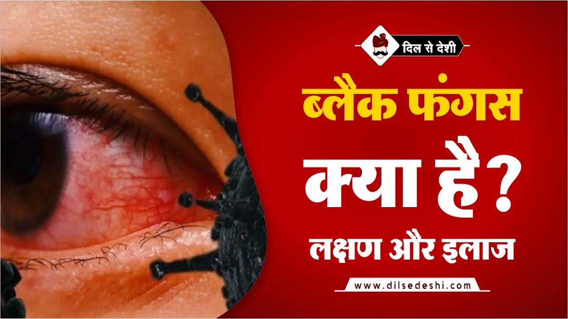 Black Fungus Symptoms, Treatment In Hindi