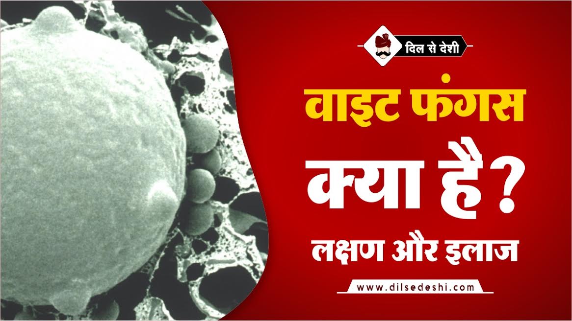 Wight Fungus Symptoms, Treatment In Hindi